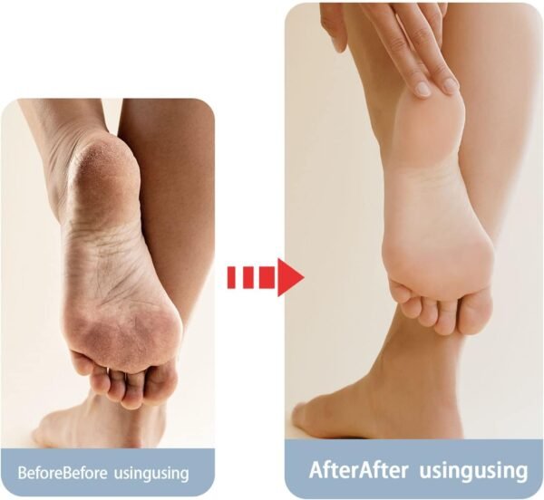 Get Soft and Smooth Feet: The Magic of Moisturizing Socks - Image 7